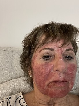 day 10