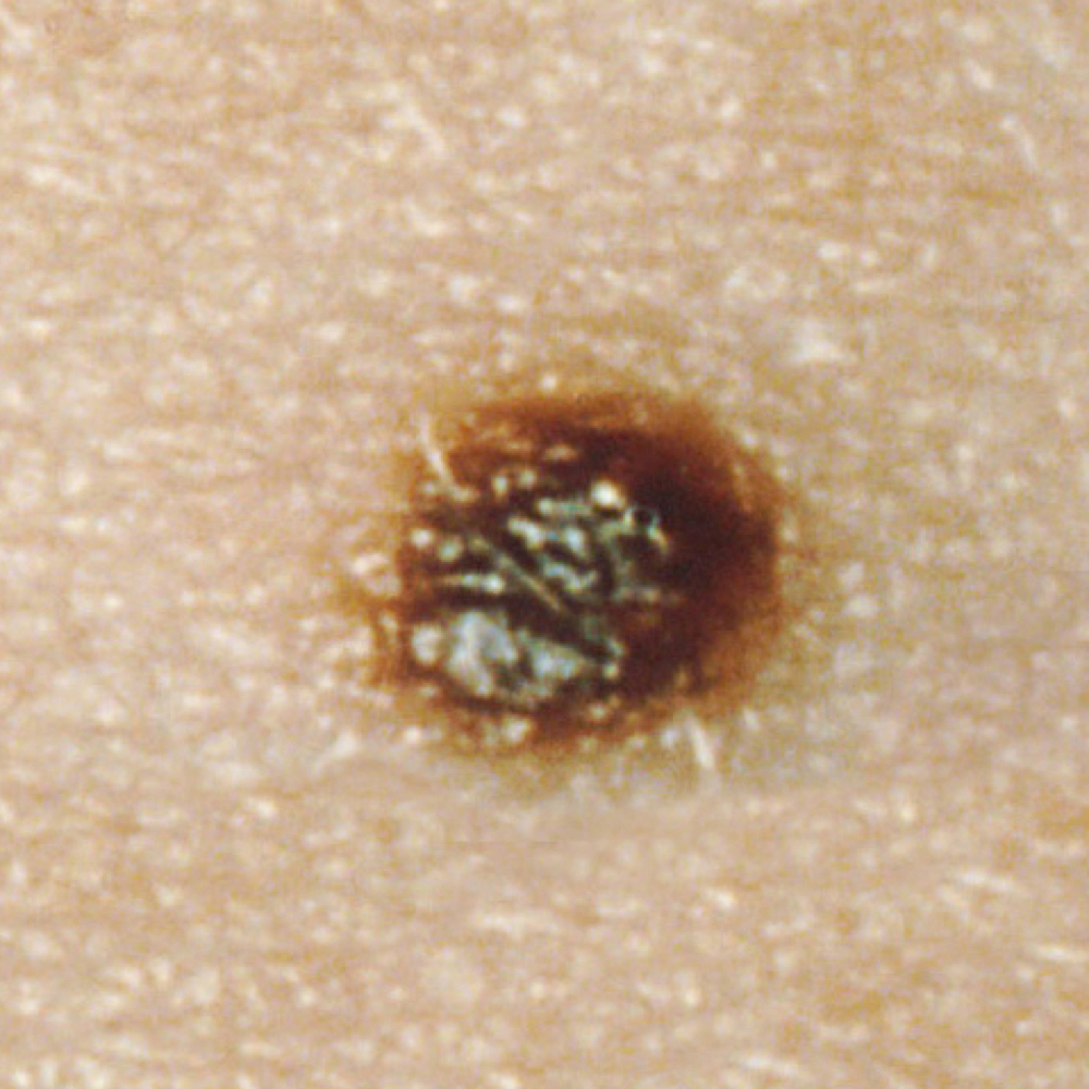 Common mole