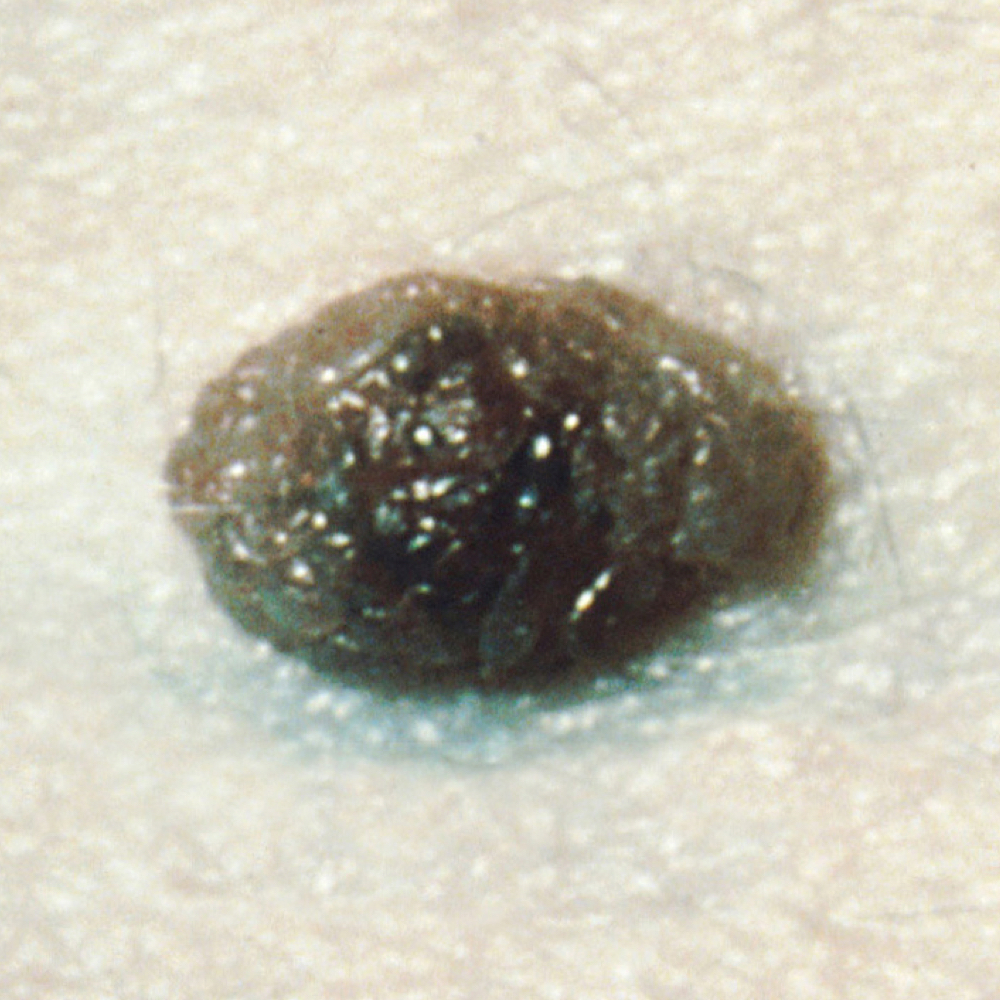 Common mole
