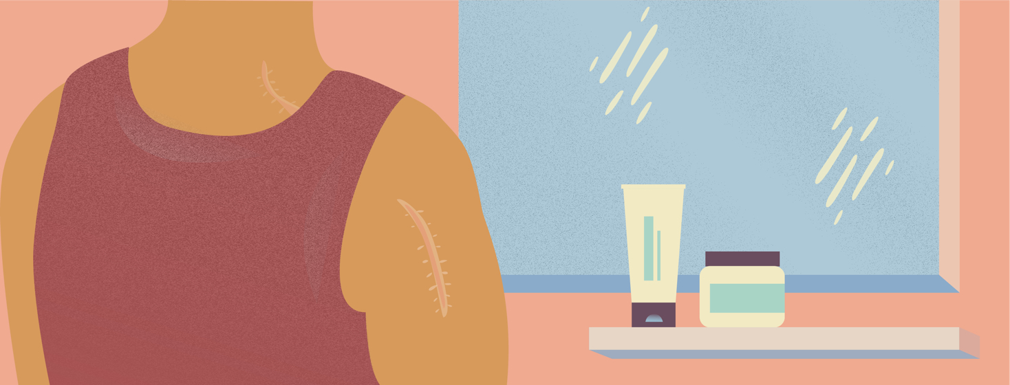Worrying About Skin Cancer Recurrence