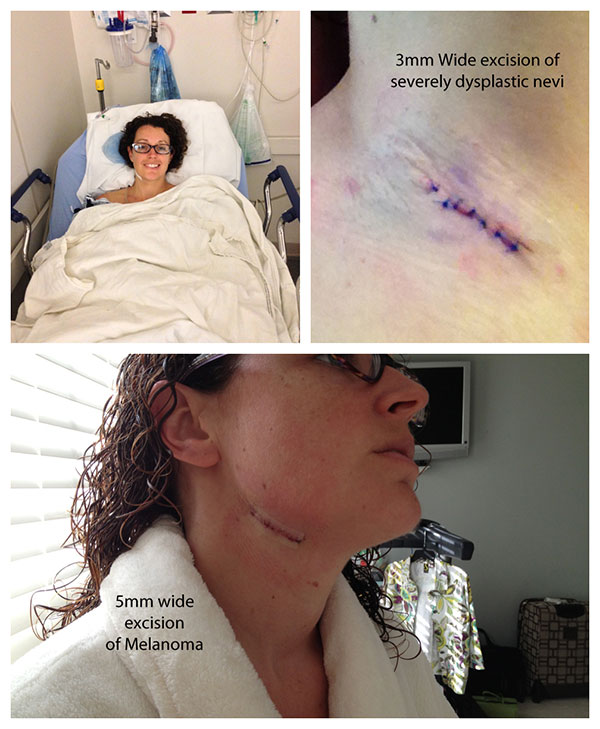 Tracy's different treatments