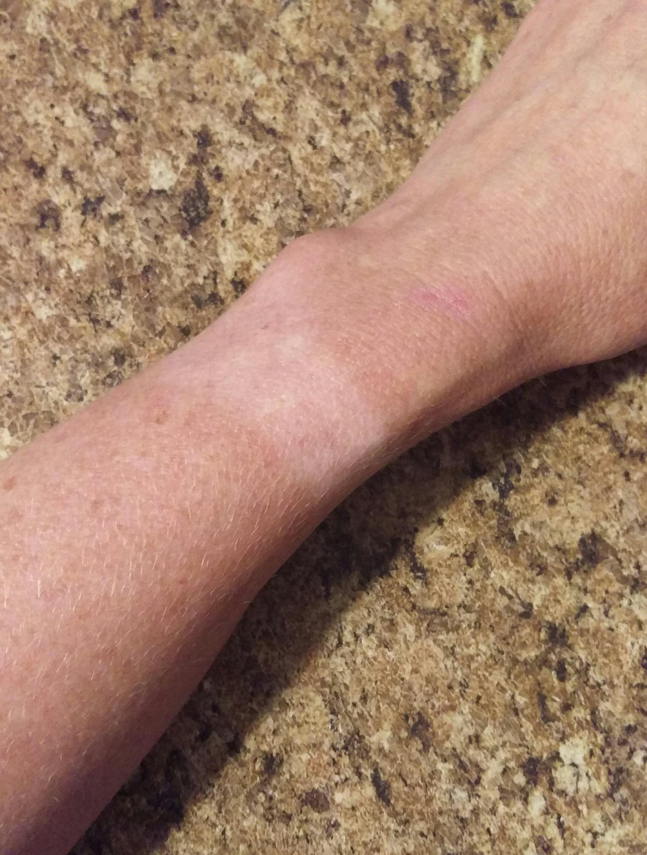 A tan line on a woman's wrist