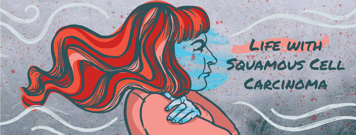 Life With Squamous Cell Carcinoma image