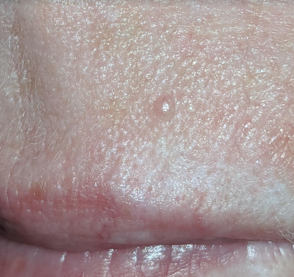 A small white dot above April's lip
