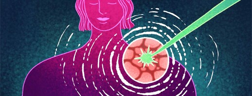 How Does Radiation Treat Skin Cancers? image