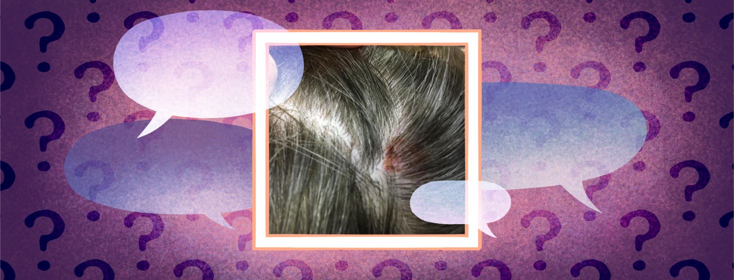 A photo of a person's scalp with a lesion surrounded by speech bubbles and question marks.
