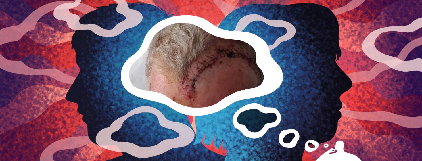 A thought bubble shows a photo of a large surgical wound on a man's scalp.