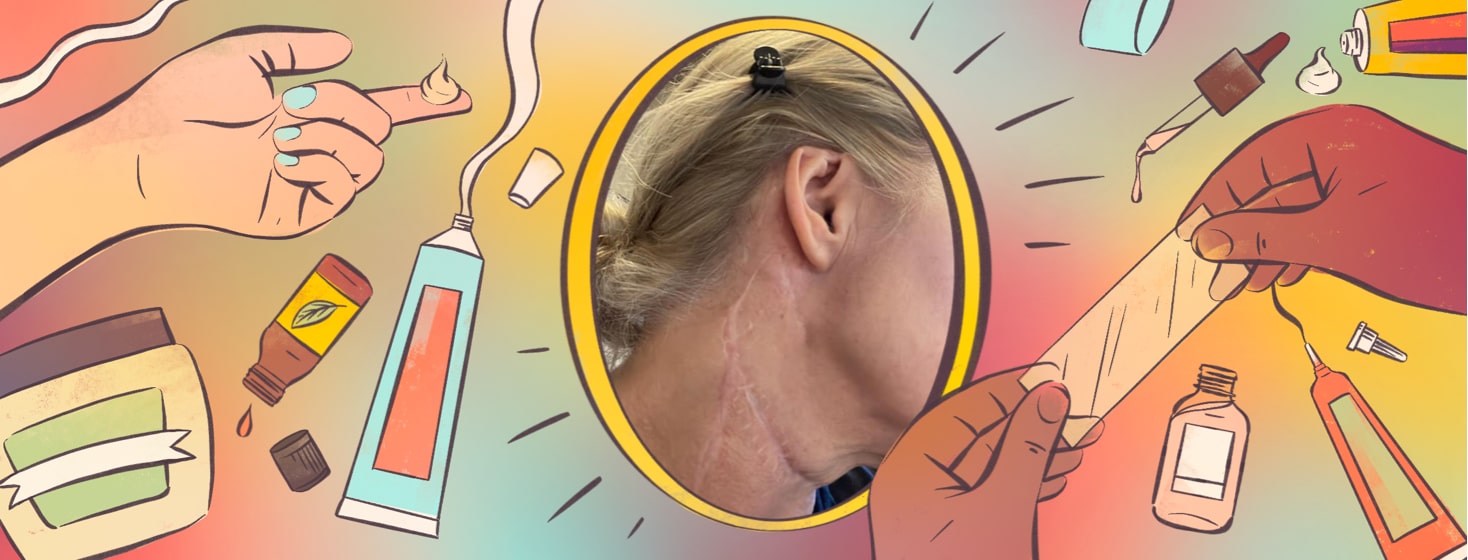 alt=a woman displays her neck scar. Remedies for reducing scar visibility float around her.