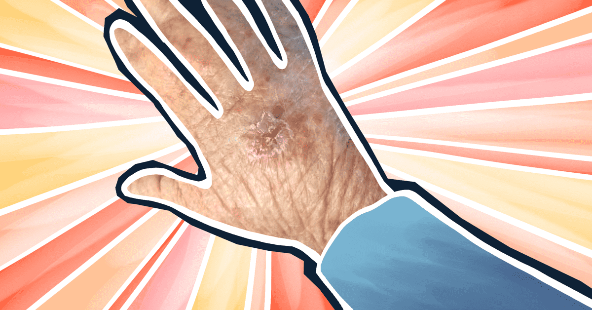 Protecting Your Hands from the Sun image