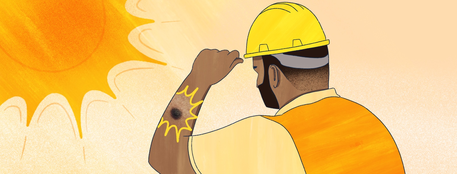 A male construction worker with tan skin adjusts his hat in the sun while a large dark mole is highlighted on his arm