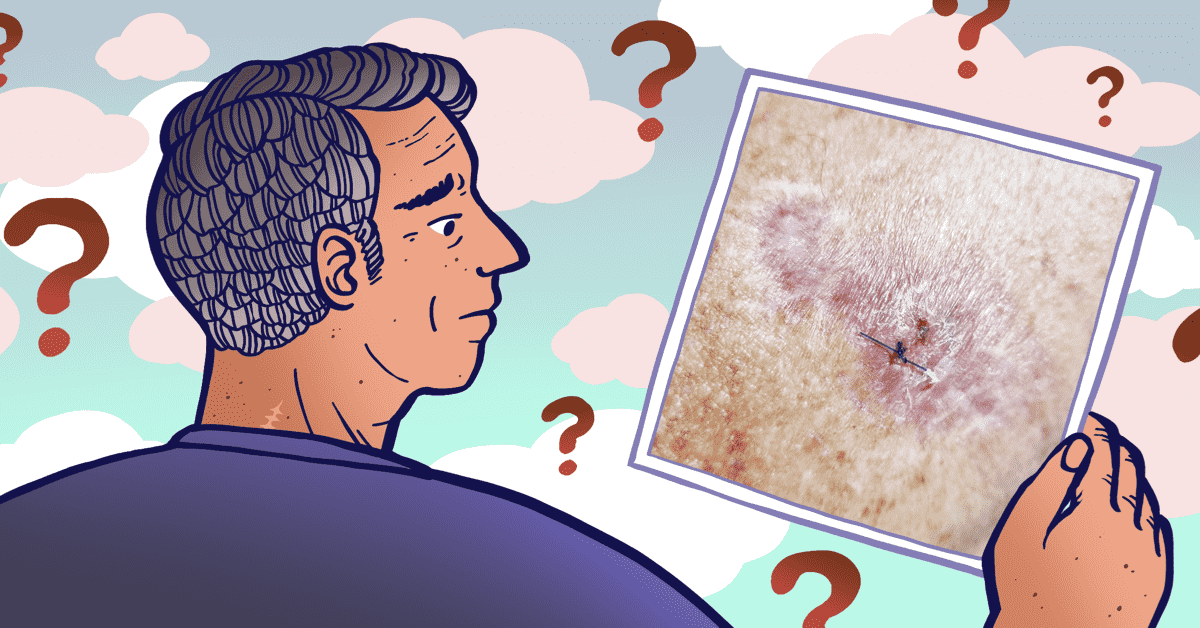 Bug Bite, Pimple, Rash, Mole, Skin Cancer? image