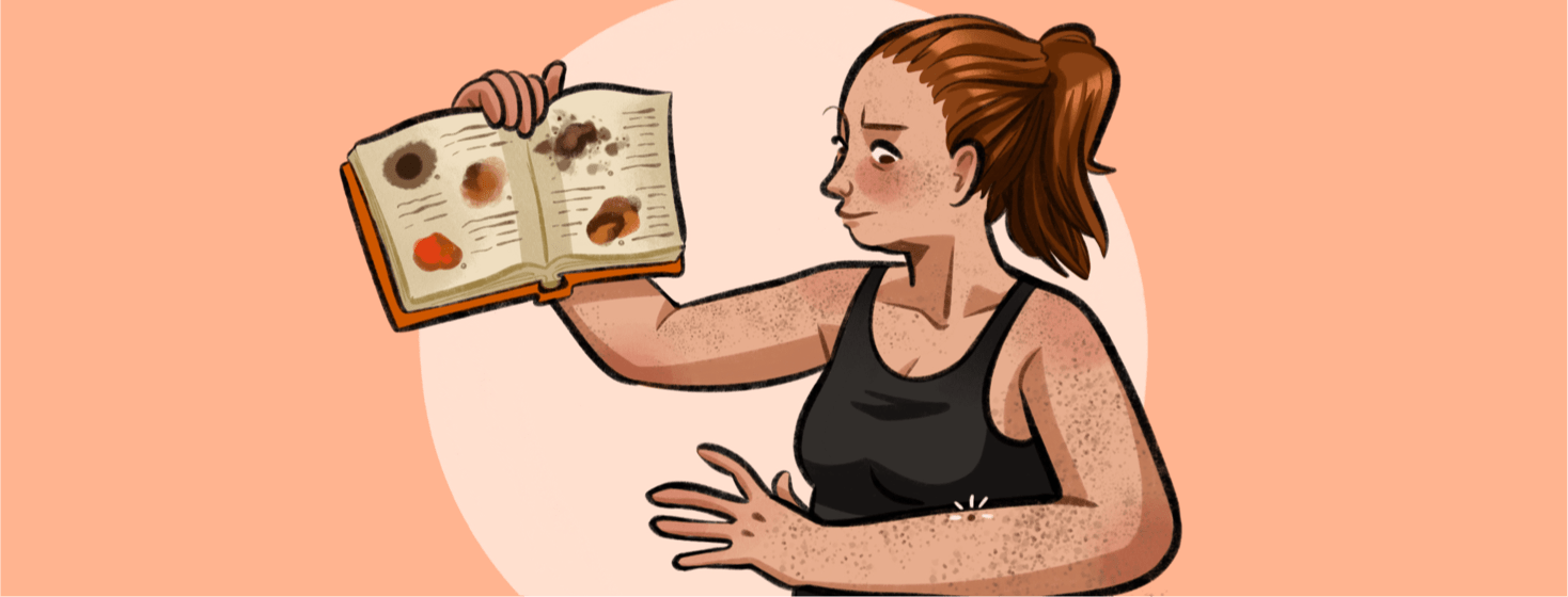 A woman is looking at a mole on her arm looking confused, in her right hand she's holding a book that details what various skin melanomas look like.